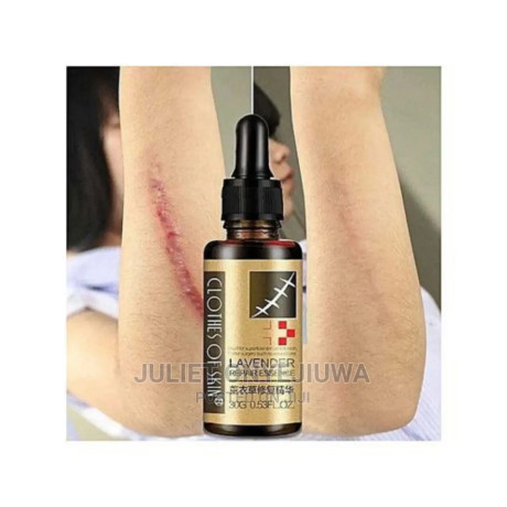 lavender-repair-essence-serum-for-stretch-marks-scars-and-b-big-1