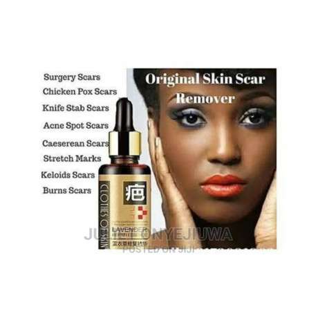 lavender-repair-essence-serum-for-stretch-marks-scars-and-b-big-0