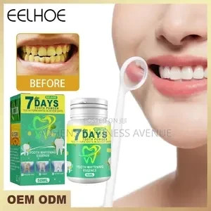 7-days-teeth-whitening-big-2