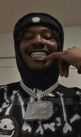 hip-hop-teeth-grillz-teeth-gold-teeth-big-0