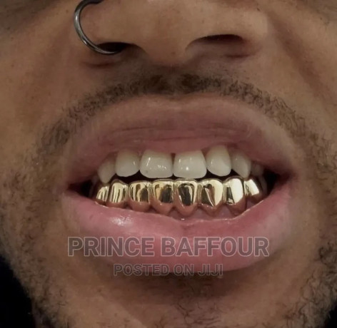 hip-hop-teeth-grillz-teeth-gold-teeth-big-1