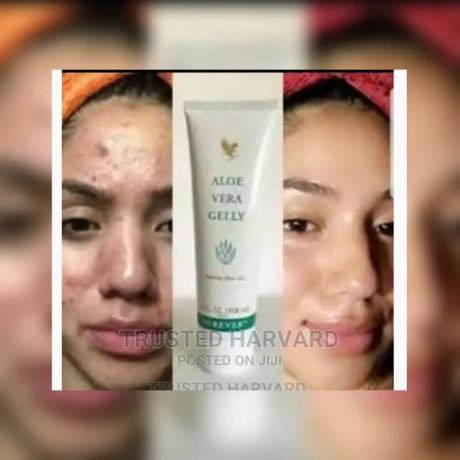 natural-solution-for-pimples-dark-spots-and-acne-big-0