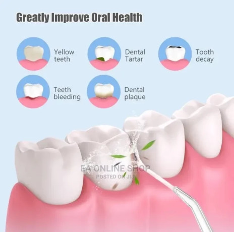 dental-jet-oral-teeth-irrigator-tooth-cleaner-water-flosser-big-2