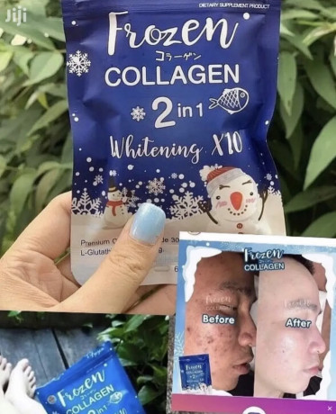 frozen-collagen-n-lachel-vitamins-c-big-0