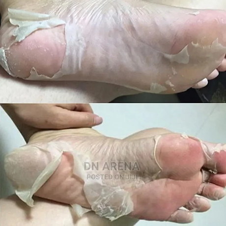 foot-mask-dead-skin-cells-remover-big-1