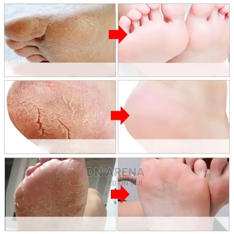 foot-mask-dead-skin-cells-remover-big-3