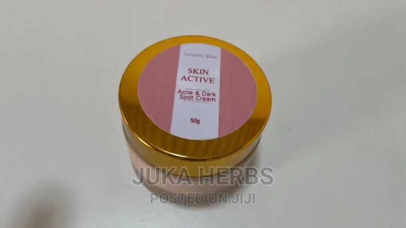 acne-and-dark-spots-cream-skin-active-big-0