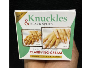Knuckles and Dark Spots Correcting Cream