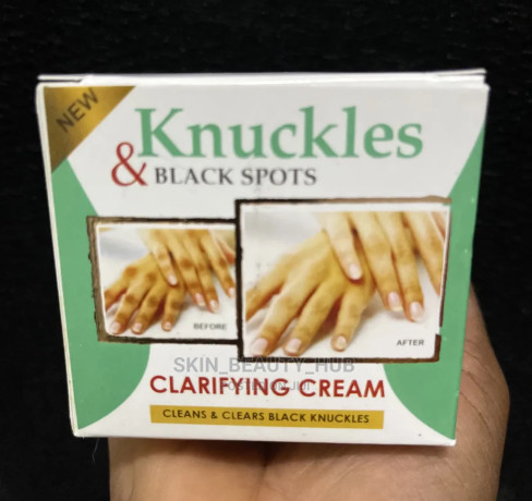 knuckles-and-dark-spots-correcting-cream-big-0