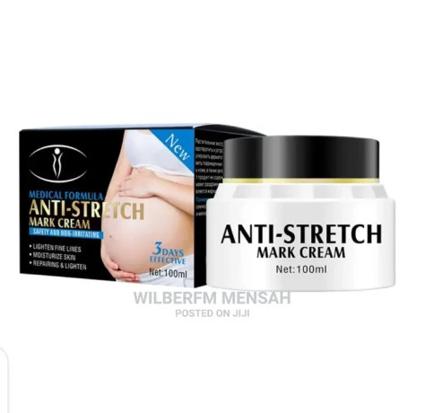 anti-stretch-marks-cream-big-0
