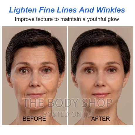 botox-stock-solution-anti-aging-serum-prevent-wrinkles-big-0